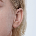 Oticon Ruby 2 miniRITE Power Hearing Aid (Chroma Beige)